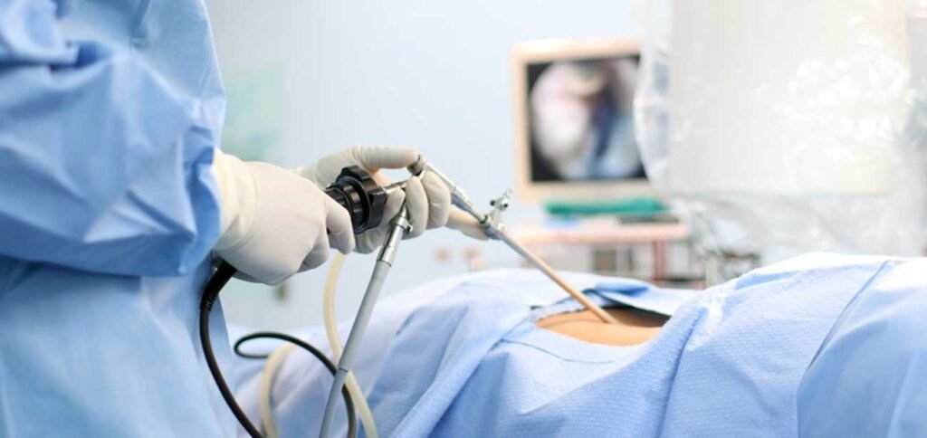 Laparoscopic Fertility Enhancing Surgeries