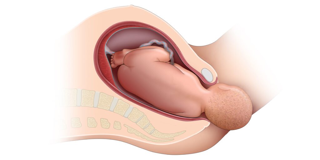 Normal Delivery - Dr. Manasi Thakur | Gynaecologist In Nagpur ...