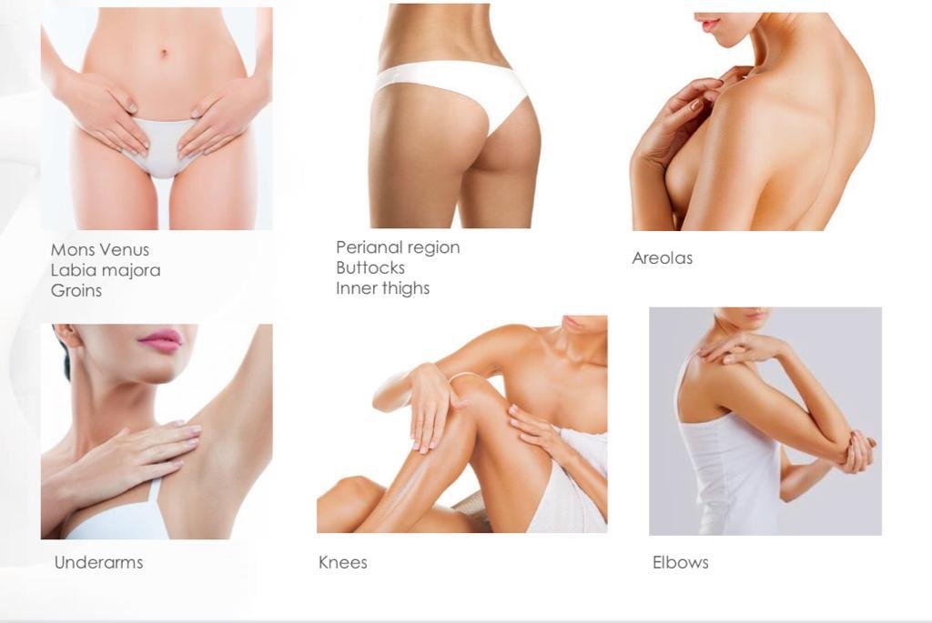 Peels for Intimate Areas