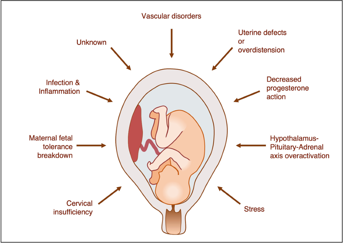Pre term Labor & delivery