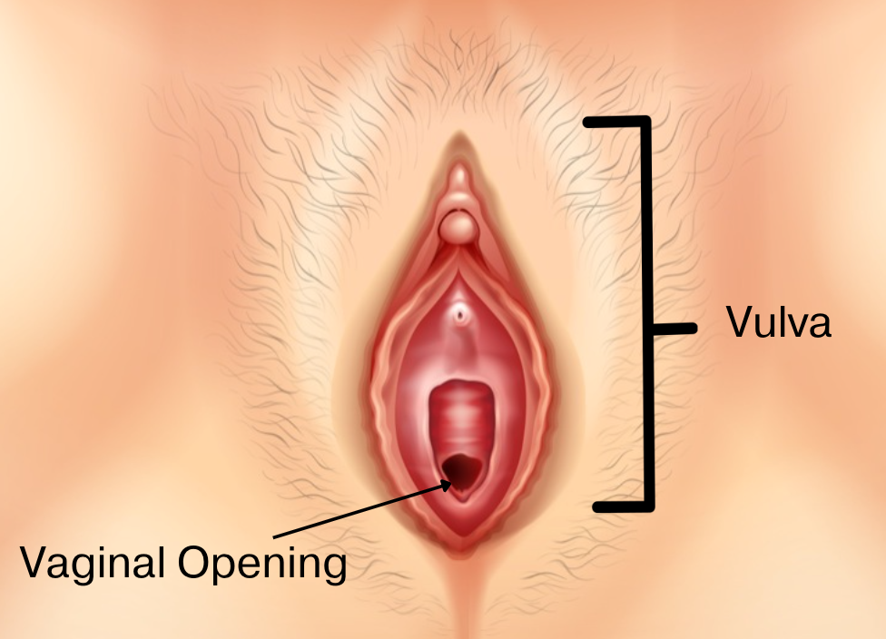 Vaginismus