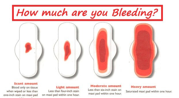 heavy bleeding during periods