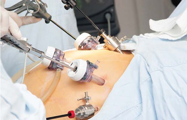 Best Laparoscopic Surgeon In Nagpur
