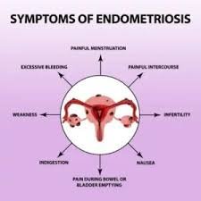 Endometriosis Specialist In Nagpur