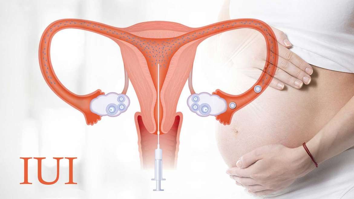 IUI Specialist In Nagpur