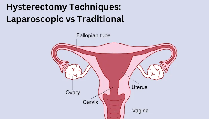 Laparoscopic Vs Open Hysterectomy In Nagpur