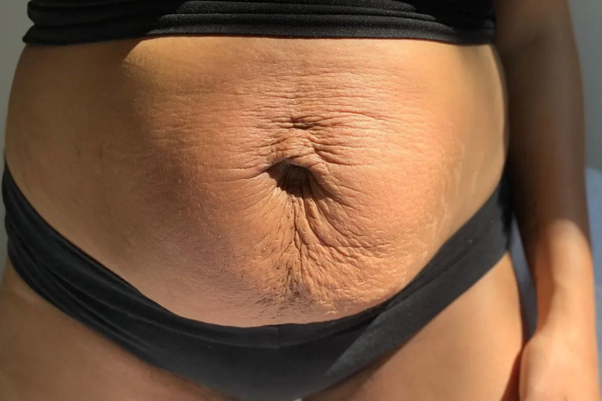 Postpartum Body Rejuvanation In Nagpur