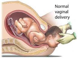 Vaginal Delivery Doctor In Nagpur