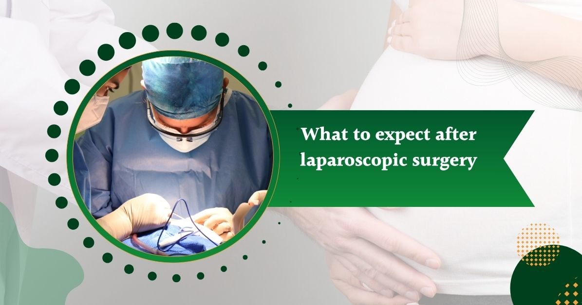 what to expect after laparoscopic surgery